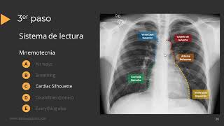 Tutorial Radiografía de Torax [upl. by Idac520]