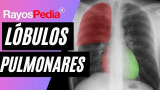 Esquematización de los lóbulos pulmonares  Rx de Tórax [upl. by Blakeley]